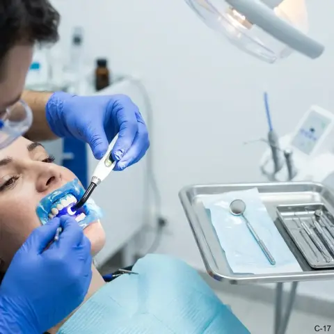 Blanqueamiento dental led estético