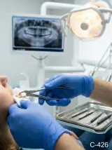 Extracción de pieza dental
