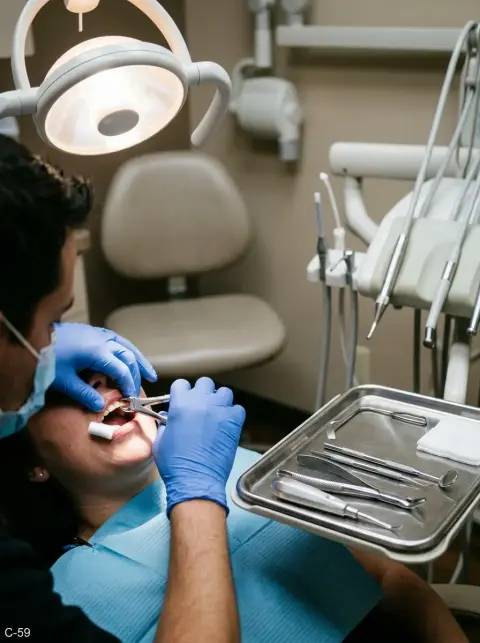 Extracción dental
