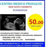 Ecografía de útero y ovarios (sede Nuevo Chimbote)
