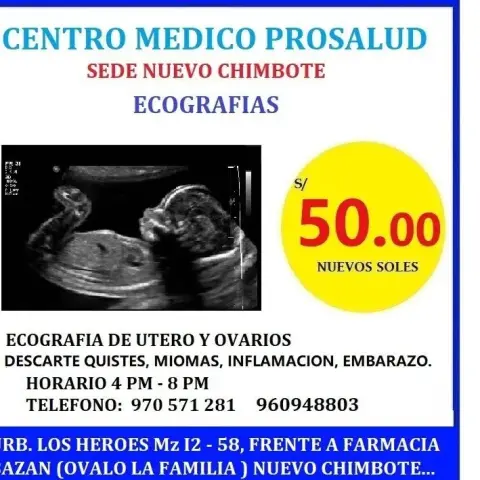 Ecografía de útero y ovarios (sede Nuevo Chimbote)