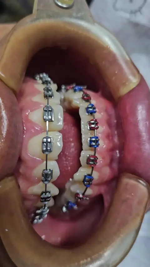 CONSULTORIO DENTAL Dra. Karla Vásquez G