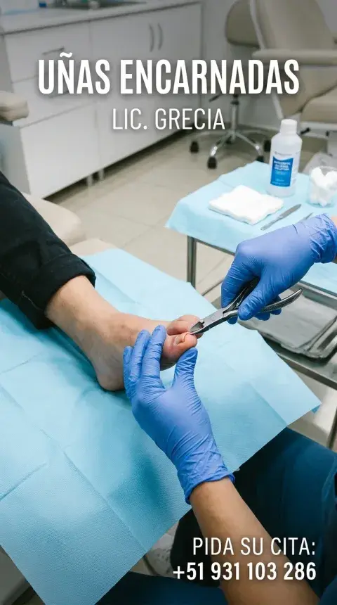 Uñas Encarnadas (Uñeros / Onicocriptosis)