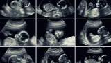 Ecografía abdominal veterinaria con informe impreso