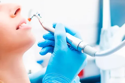 Profilaxis dental completa con ultrasonido, bicarbonato y pulido para eliminar sarro y manchas