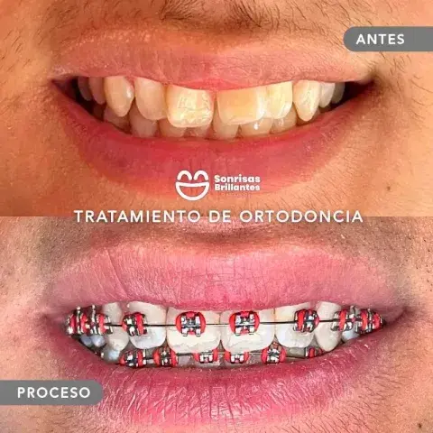 Sonrisas Brillantes