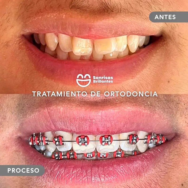 Sonrisas Brillantes